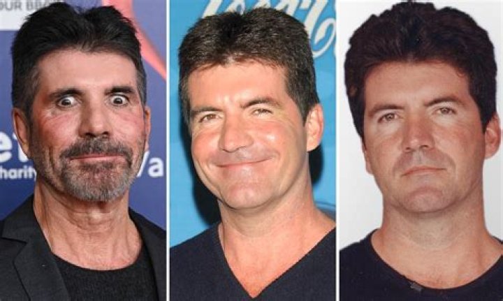 Simon Cowell: Overcoming Adversity And Disability