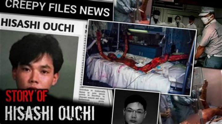 The Tragic Story Of Hisashi Ouchi: A Case Of Human Suffering And Negligence